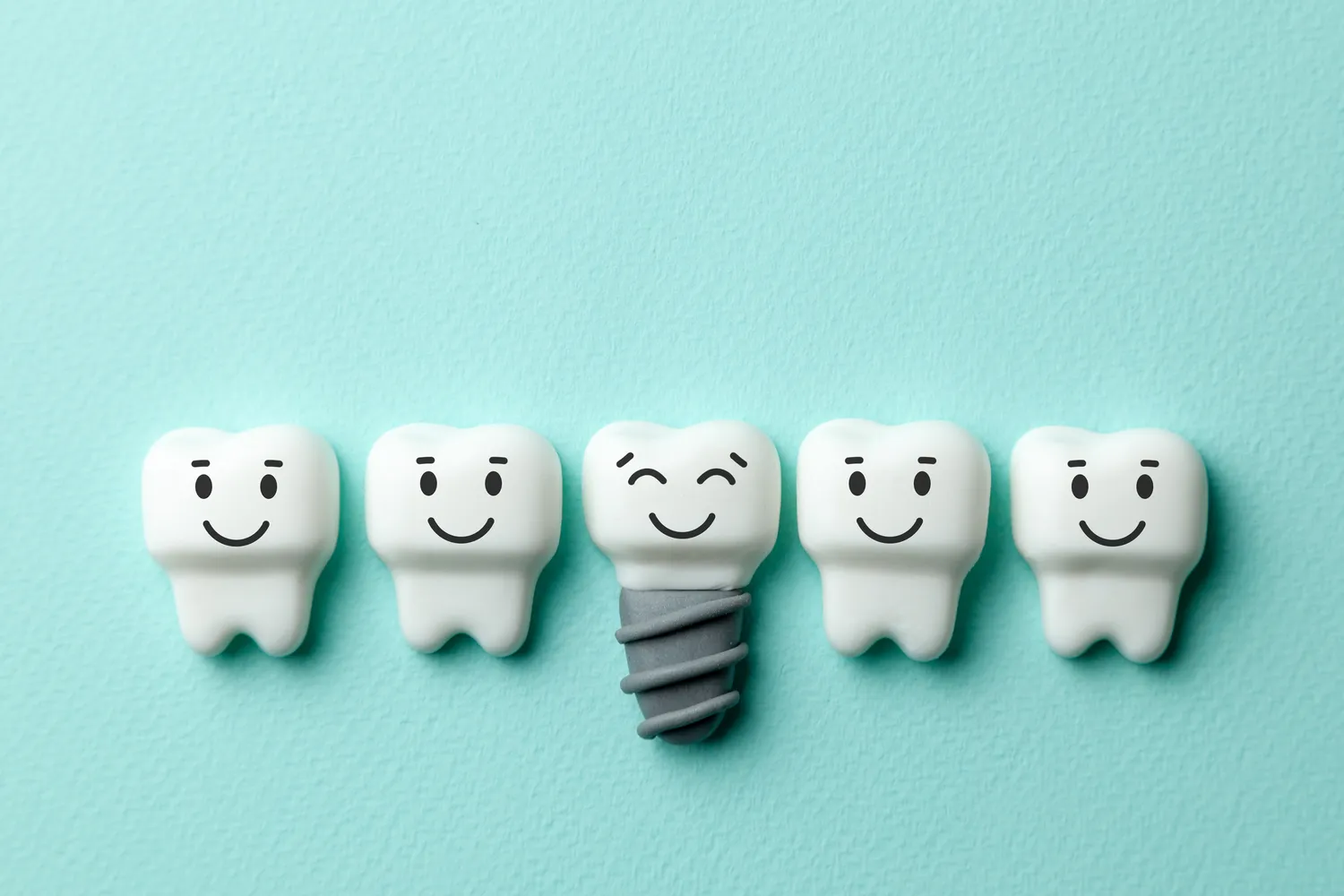 Ile kosztują implanty zębów w Niemczech?