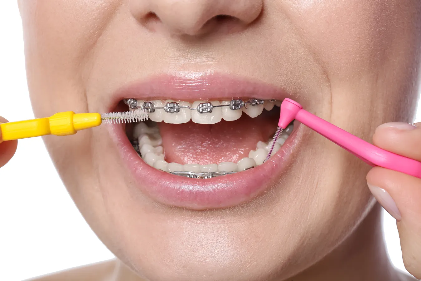 Leczenie kanałowe kiedy?